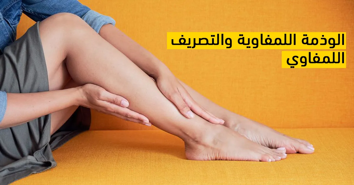 الوذمة اللمفاوية والتصريف اللمفوي